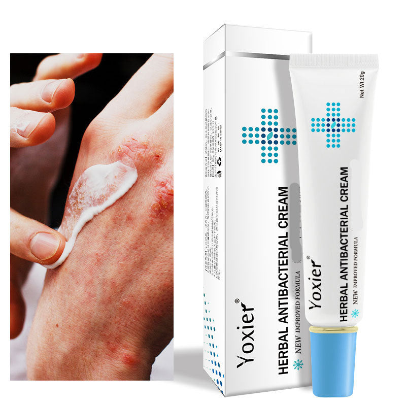 Psoriasis Creams