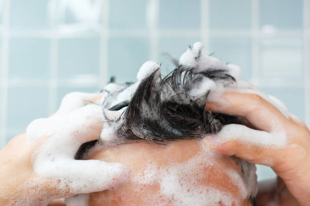 Shampoo for Psoriasis on Head Australia