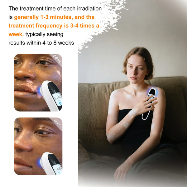 GlowEase UV Therapy Lamp