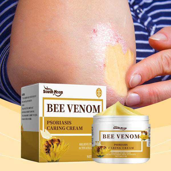 Bee Venom Psoriasis Ointment