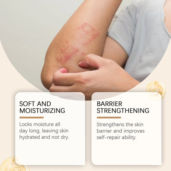 Eczema Benefits