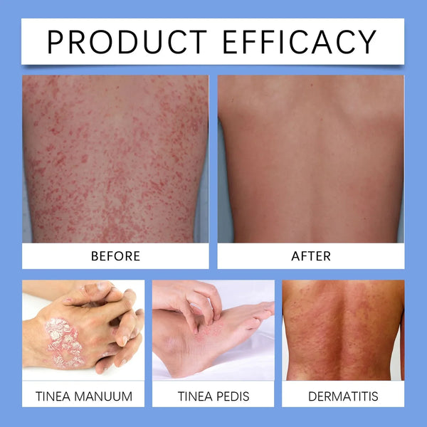 Gentle Skin Rescue Spray