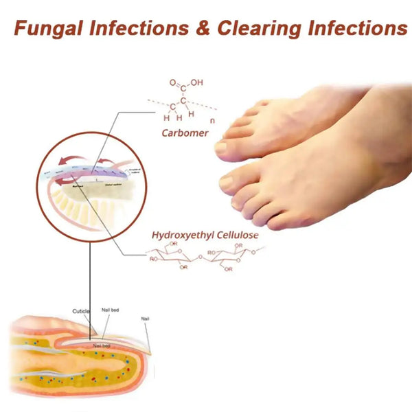 Fungal Infections