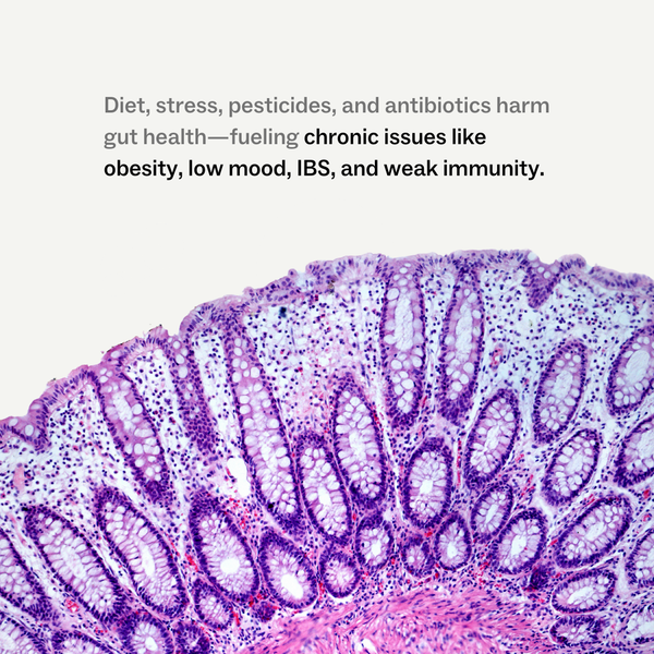Causes