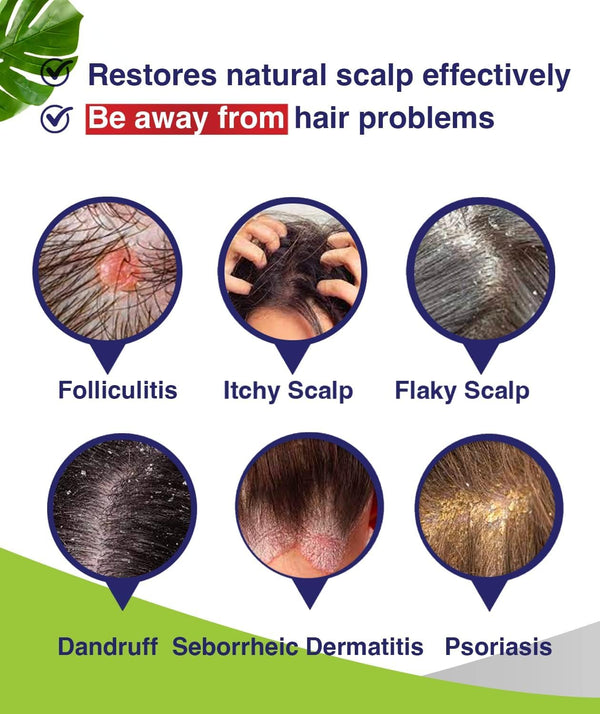 Itch-Free Scalp Shampoo