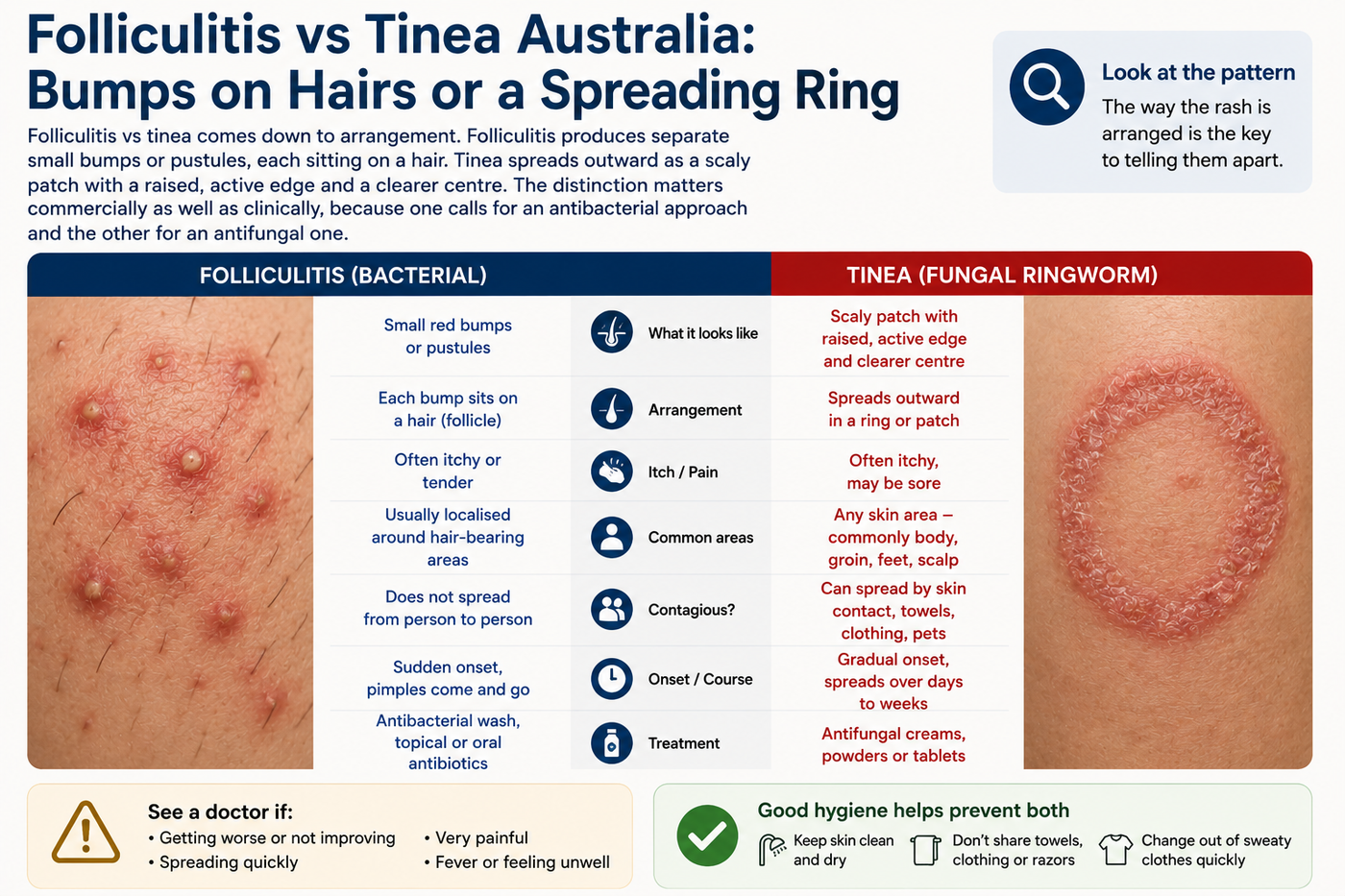 Folliculitis vs Tinea Australia