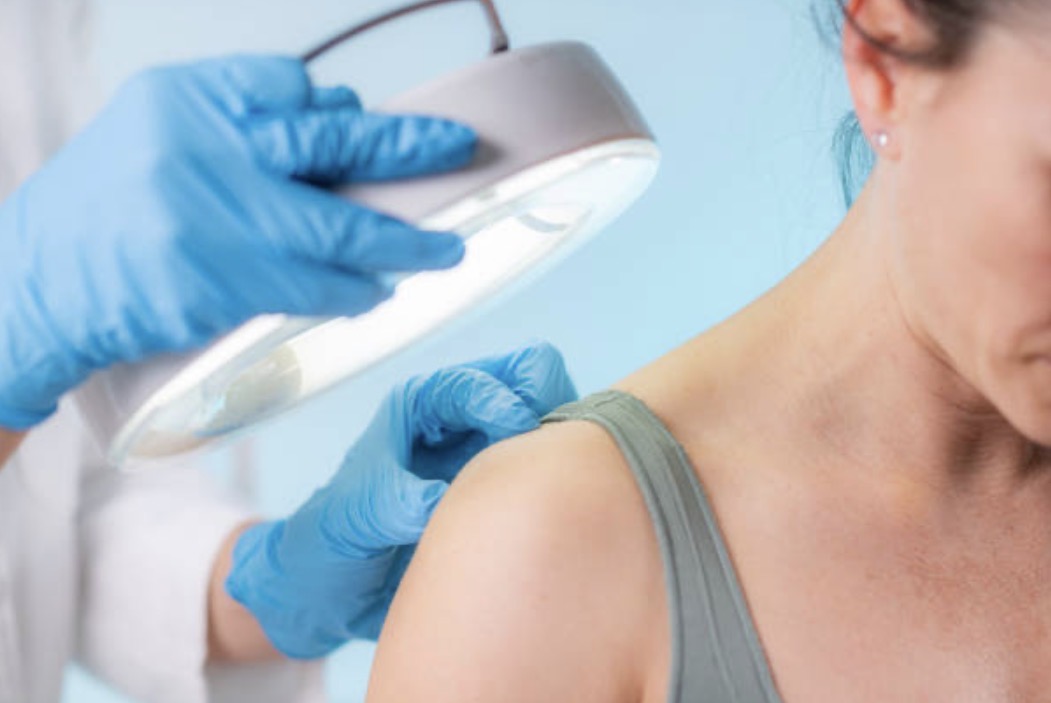 What Happens at a Skin Check Australia