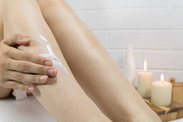 Keratosis Pilaris Cream Australia