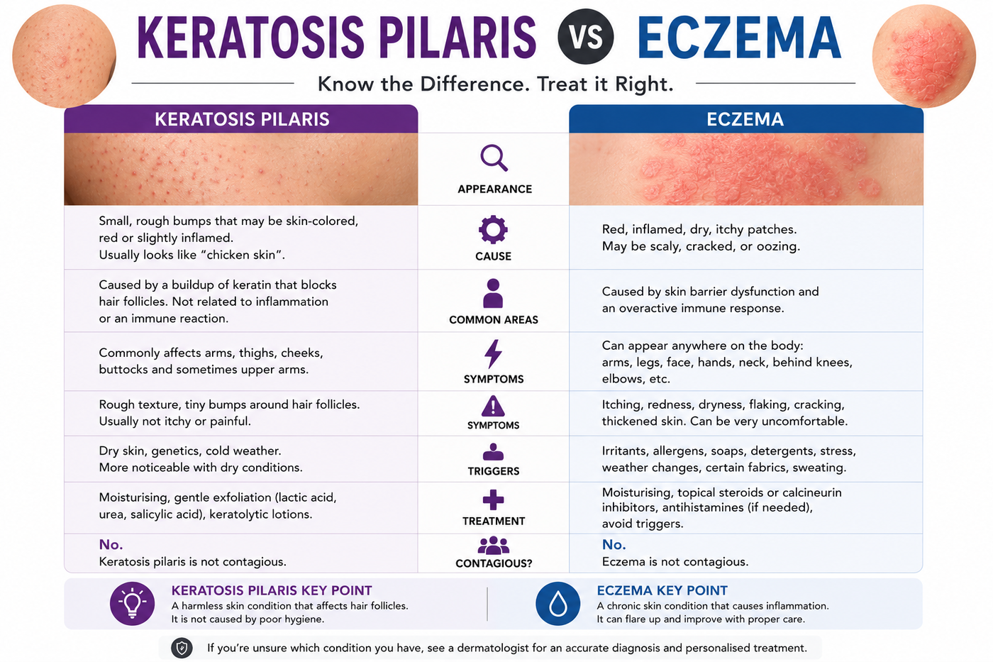 Keratosis Pilaris vs Eczema Australia