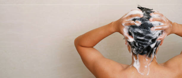 ketoconazole shampoo for seborrhoeic dermatitis australia
