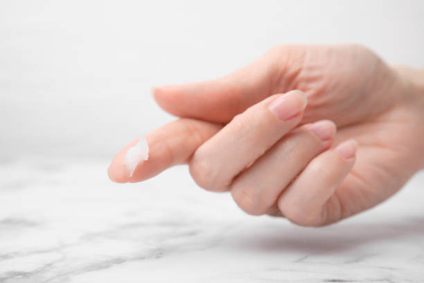 Petrolatum for Eczema Australia