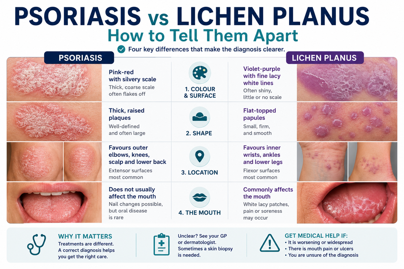 Psoriasis vs Lichen Planus Australia