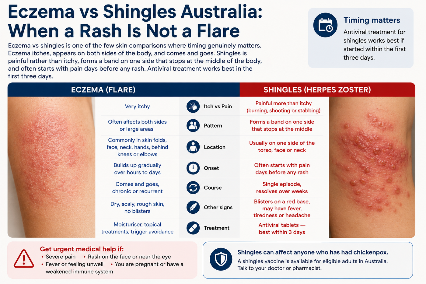 Eczema vs Shingles Australia