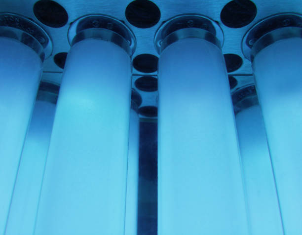 UVB Light Therapy Dosage for Psoriasis