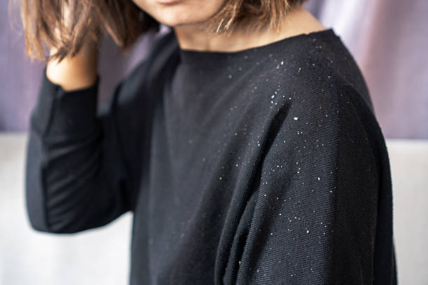 Best Anti-Dandruff Shampoo Australia