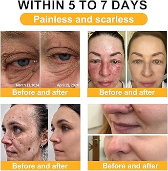 bee venom cream reviews before and after