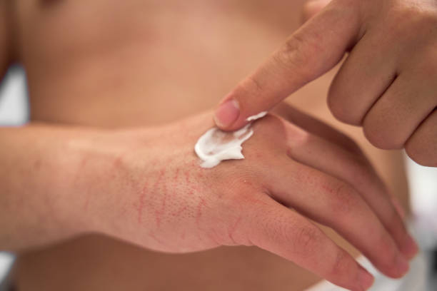 Best Bee Venom Cream Australia