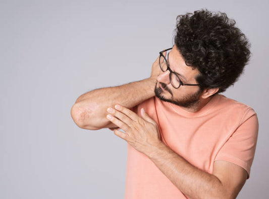 can psoriasis leave scars
