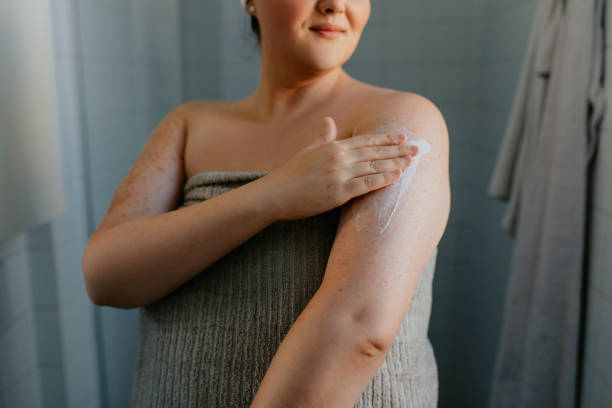 Ceramide Cream for Eczema Australia