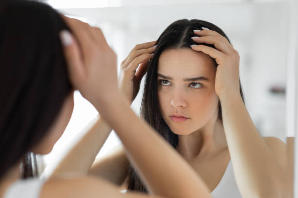 can coal tar shampoo cause hair loss australia