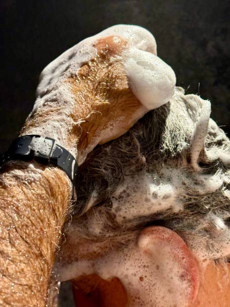 how long does coal tar shampoo take to work