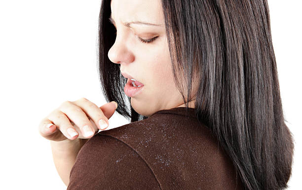 Anti-Dandruff vs Medicated Shampoo for Psoriasis Australia