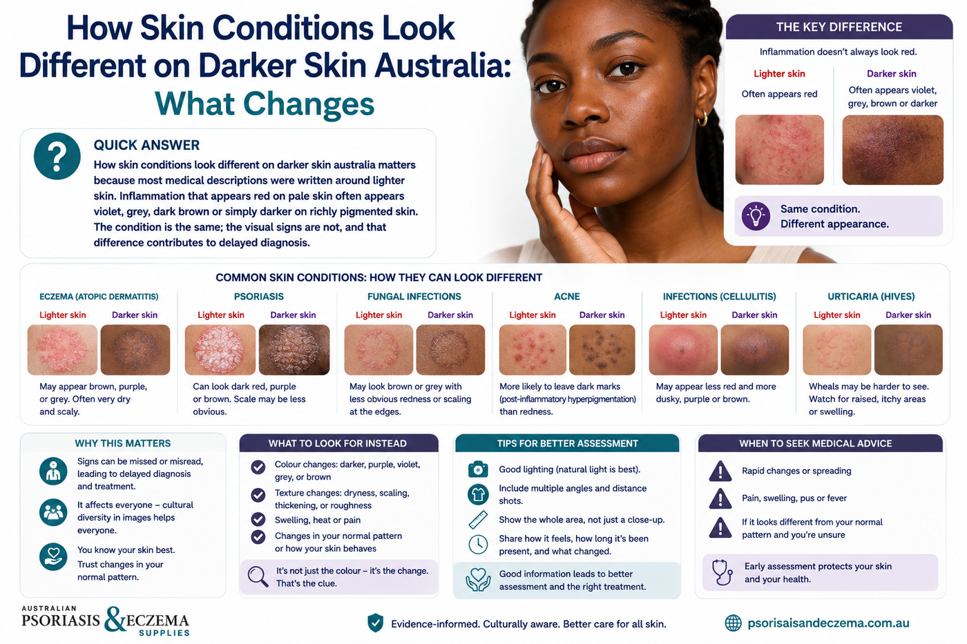 How Skin Conditions Look Different on Darker Skin Australia