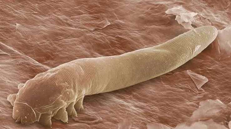 Demodex Mites and Rosacea Australia