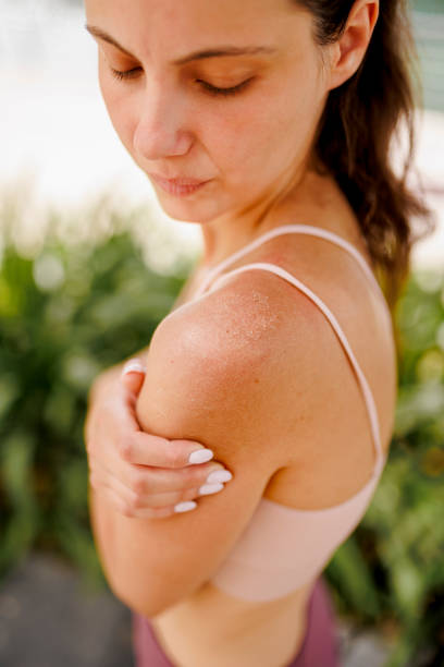 Dry Skin in Summer Australia