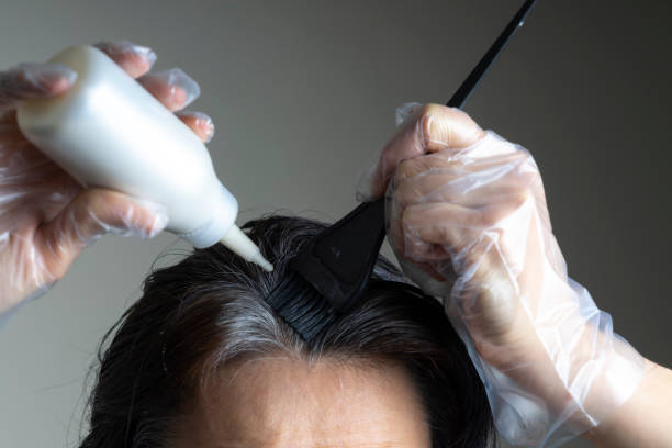 Eczema and Hair Dye Australia