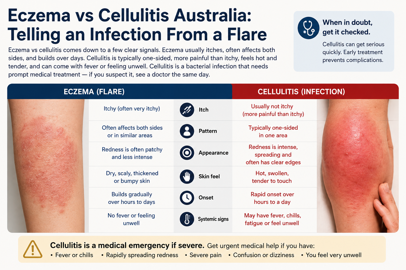 Eczema vs Cellulitis Australia