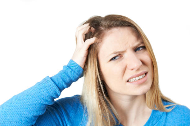eczema on scalp vs seborrheic dermatitis australia