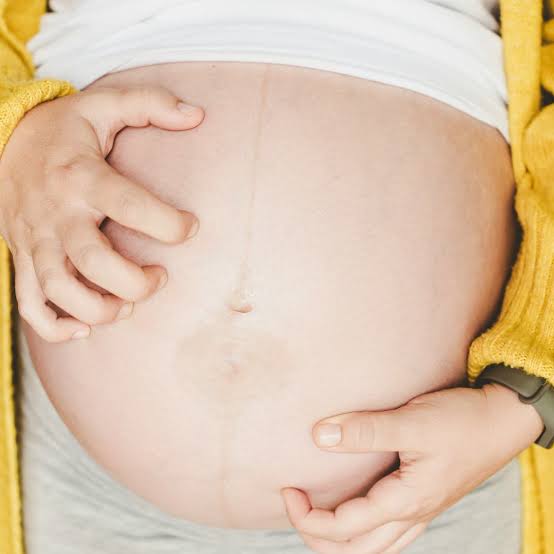Eczema Before, During and After Pregnancy Australia