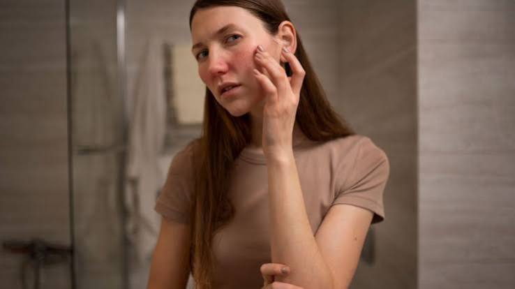 Which Cosmetic Ingredients Irritate Reactive Skin Australia