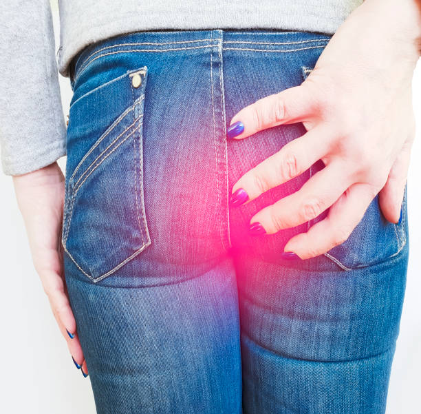 Folliculitis on Buttocks Australia