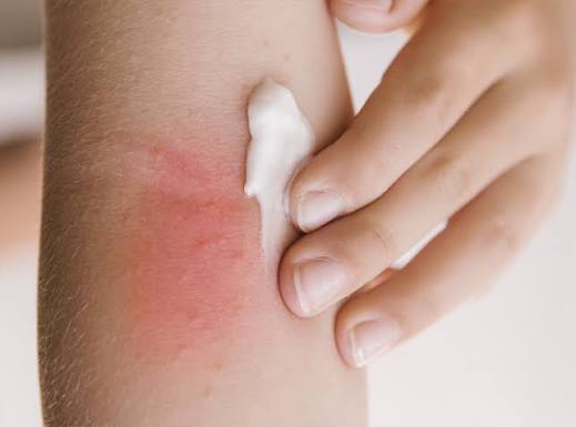 Glycerin for Eczema Australia