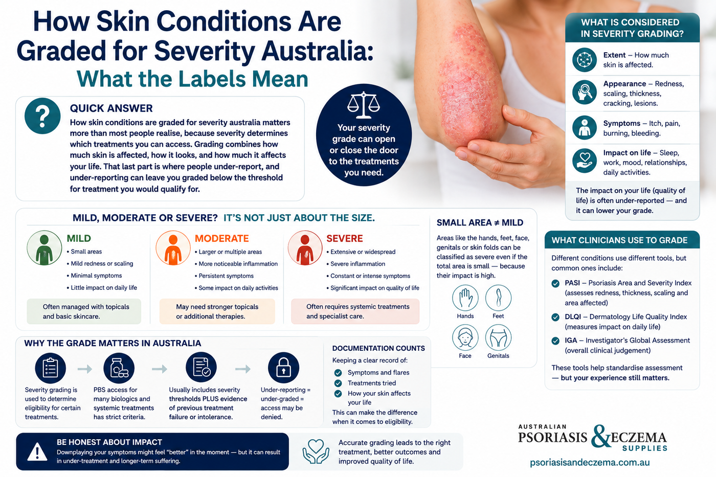 How Skin Conditions Are Graded for Severity Australia
