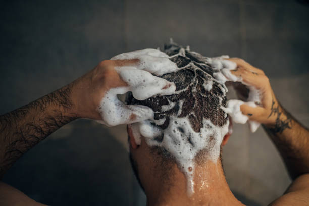 how often should you wash scalp psoriasis hair australia