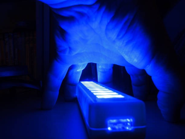 Handheld UVB Lamp for Psoriasis