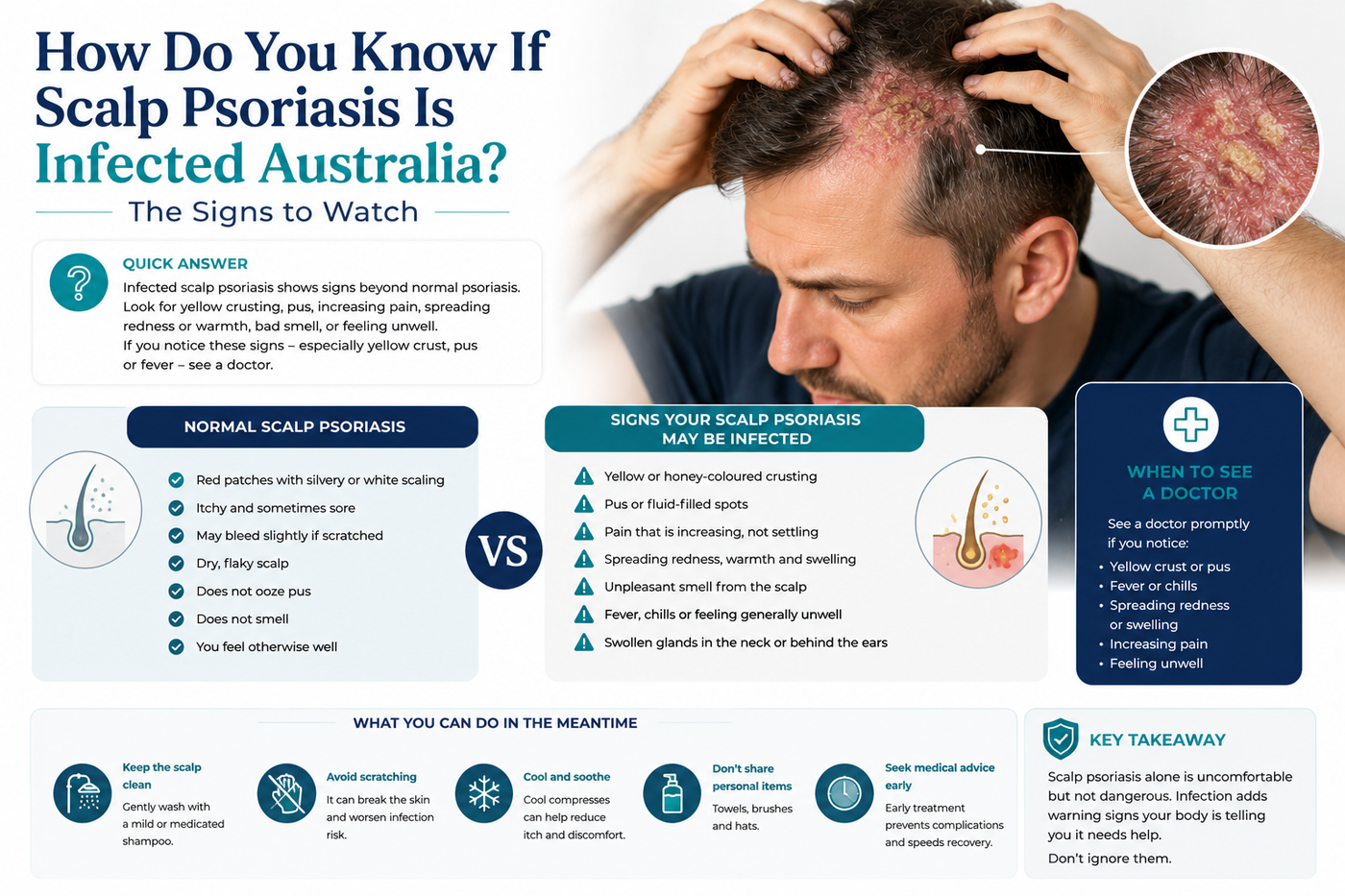 How Do You Know If Scalp Psoriasis Is Infected Australia