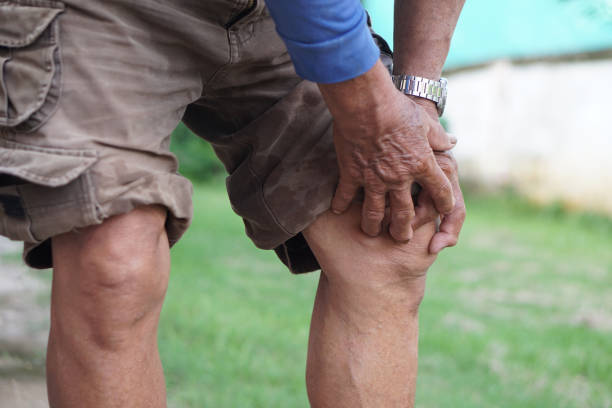 Is Bee Venom Cream Good for Arthritis