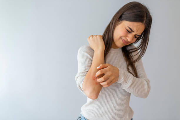 Itchy Skin Treatment Australia