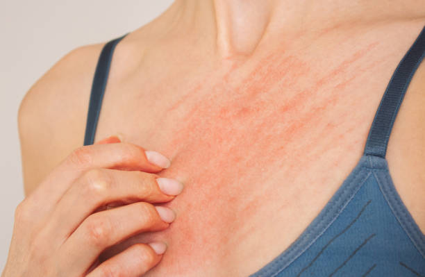 Best Body Wash for Itchy Skin Australia