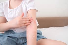 What to Do After UVB Light Therapy Australia