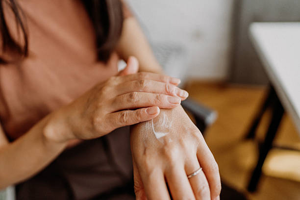 Psoriasis Moisturising Routine Australia