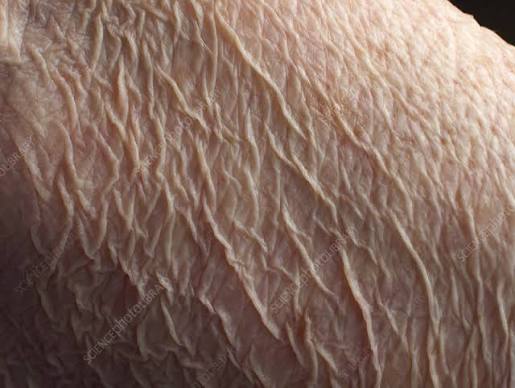 Does Sensitive Skin Get Worse With Age Australia