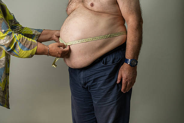 Psoriasis and Weight Australia