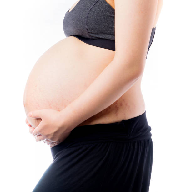 psoriasis and pregnancy australia