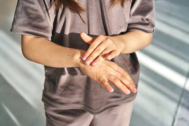 Psoriasis Cream for Hands and Fingers Australia