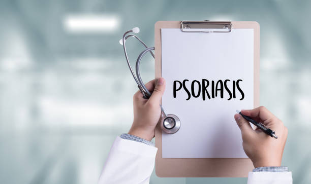 Psoriasis Misdiagnosis
